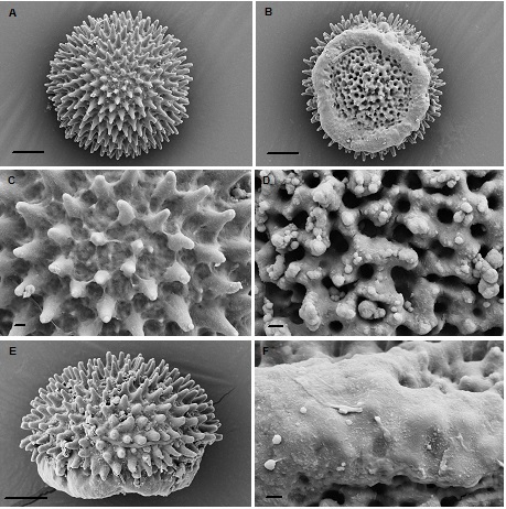 Monocarpus sphaerocarpus spores. D.J.Carr s.n., Australia. A distal view; B proximal view; C fine distal ornamentation; D fine proximal ornamentation at centre; E side view; F fine proximal ornamentation at margin. Scale bars: A, B, E, 10 µm; scale bars: C, D, F, 1 µm. Equatorial diameter of spores between 41.9-51.7 µm.