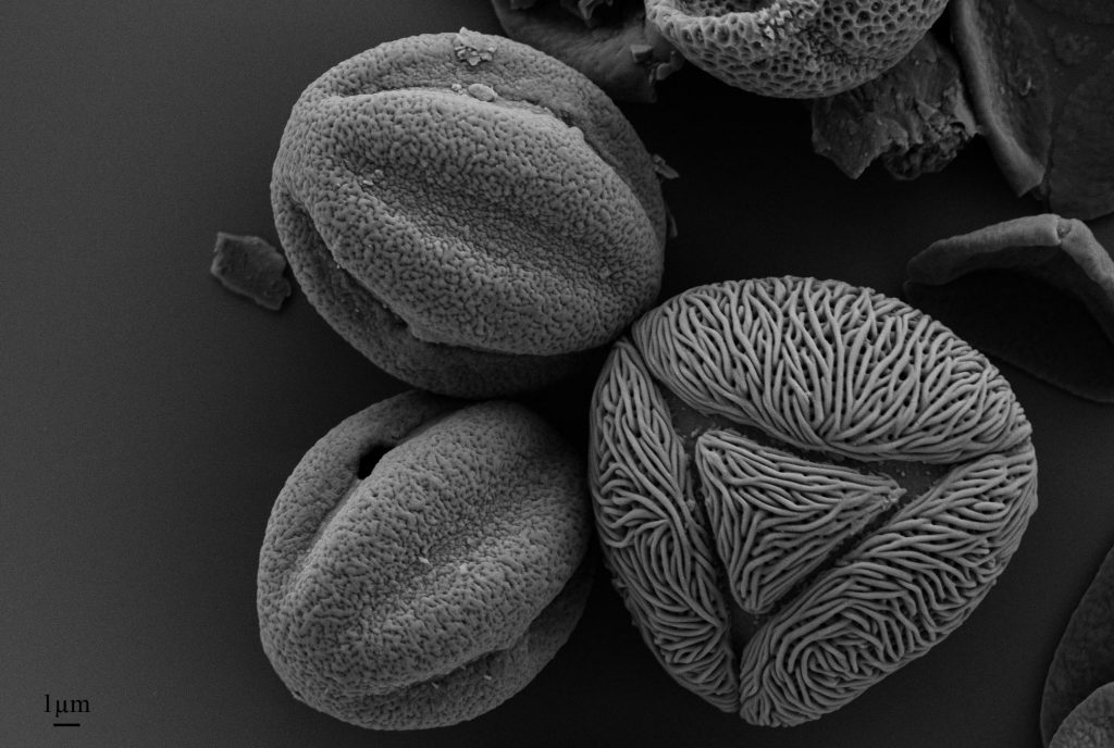 SEM of Pollen Extracted from Nepalese Honey